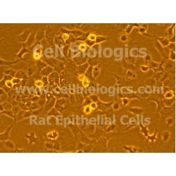 Diabetic Mouse Alveolar Epithelial Cells